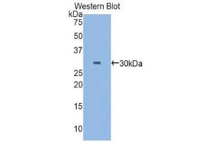 Western Blotting (WB) image for anti-Myosin Heavy Chain 3, Skeletal Muscle, Embryonic (MYH3) (AA 1403-1645) antibody (ABIN1859927) (MYH3 Antikörper  (AA 1403-1645))
