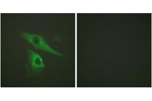 Immunofluorescence analysis of HeLa cells, using Keratin 8 (Ab-73) Antibody. (KRT8 Antikörper  (AA 41-90))