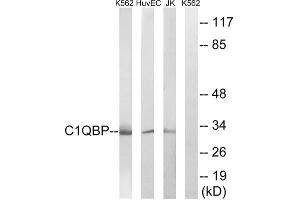 Western blot analysis of extracts from Jurkat cells, K562 cells and HUVEC cells, using C1QBP antibody. (C1QBP Antikörper  (Internal Region))