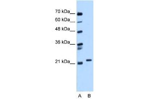 WB Suggested Anti-RAB11B Antibody Titration:  0. (RAB11B Antikörper  (C-Term))