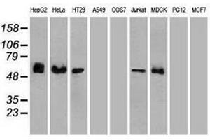 Image no. 6 for anti-Checkpoint Kinase 2 (CHEK2) antibody (ABIN1497499) (CHEK2 Antikörper)