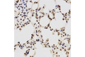 Immunohistochemistry of paraffin-embedded mouse lung using Asymmetric DiMethyl-Histone H3-R17 antibody (ABIN1872982) at dilution of 1:200 (40x lens). (Histone 3 Antikörper  (H3R17me2a))