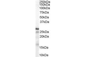 ABIN184587 (1µg/ml) staining of Human Breast lysate (35µg protein in RIPA buffer). (CDKN1B Antikörper  (C-Term))
