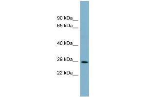 WB Suggested Anti-DCUN1D1  Antibody Titration: 0. (DCUN1D1 Antikörper  (Middle Region))
