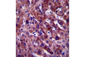 Immunohistochemistry analysis in formalin fixed and paraffin embedded human liver tissue reacted with PON1 Antibody (Center) followed which was peroxidase conjugated to the secondary antibody and followed by DAB staining. (PON1 Antikörper  (Middle Region))
