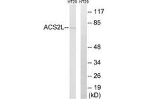 Western blot analysis of extracts from HT-29 cells, using ACSS1 Antibody. (ACSS1 Antikörper)