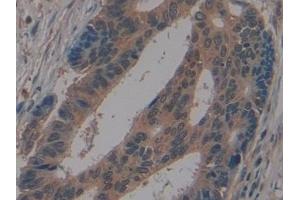 Immunohistochemistry (IHC) image for anti-Golgi Glycoprotein 1 (GLG1) (AA 1048-1145) antibody (ABIN7439525)