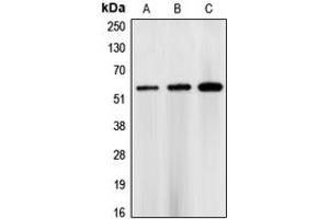 Western blot analysis of CHK1 expression in HEK293T (A), NIH3T3 (B), rat heart (C) whole cell lysates. (CHEK1 Antikörper  (Center))