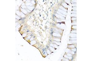 Immunohistochemistry of paraffin-embedded human colon using CPA1 antibody. (CPA1 Antikörper)