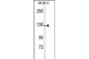 Western blot analysis of ANPEP antibody (Center) (ABIN391875 and ABIN2841695) in SK-Br-3 cell line lysates (35 μg/lane). (CD13 Antikörper  (AA 615-641))