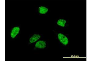 Immunofluorescence of purified MaxPab antibody to A1CF on HeLa cell.