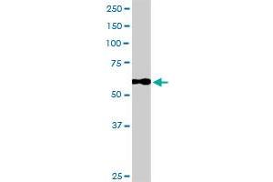 CALD1 MaxPab rabbit polyclonal antibody. (Caldesmon Antikörper  (AA 1-538))