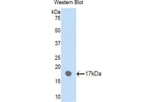 Western blot analysis of the recombinant protein. (PLXNB1 Antikörper  (AA 47-173))
