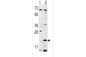 Western blot analysis of FXN using rabbit polyclonal FXN Antibody using 293 cell lysates (2 ug/lane) either nontransfected (Lane 1) or transiently transfected with the FXN gene (Lane 2). (Frataxin Antikörper  (C-Term))