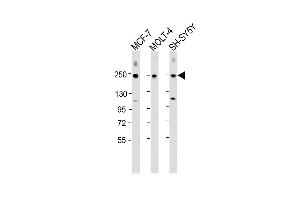 Western Blot at 1:2000 dilution Lane 1: MCF-7 whole cell lysate Lane 2: MOLT-4 whole cell lysate Lane 3: SH-SY5Y whole cell lysate Lysates/proteins at 20 ug per lane. (CUX1 Antikörper  (C-Term))