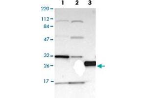 Western Blot analysis of (1) Human RT-4 cell, (2) Human U-251MG sp cell, (3) Human plasma (IgG/HSA depleted).