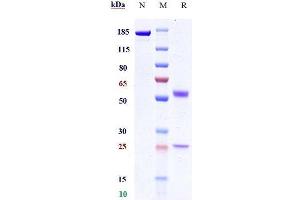 Anti-PVRIG Reference Antibody (GSK4381562) on SDS-PAGE under reducing (R) condition.