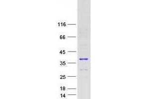 Western Blotting (WB) image for Phosphotyrosine Interaction Domain Containing 1 (PID1) (Transcript Variant 1) protein (Myc-DYKDDDDK Tag) (ABIN2728867)