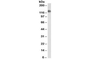 Western blot testing of ThP1 cell lysate with CD31 antibody (clone JC/70A). (CD31 Antikörper)