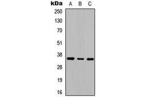 Western blot analysis of Adenosine A2b Receptor expression in SHSY5Y (A), NIH3T3 (B), rat kidney (C) whole cell lysates. (Adenosine A2b Receptor Antikörper  (C-Term))