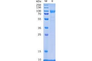 Human CD114 Protein, His Tag on SDS-PAGE under reducing condition.