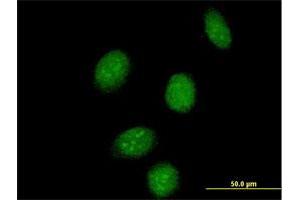 Immunofluorescence of purified MaxPab antibody to SSBP2 on HeLa cell. (SSBP2 Antikörper  (AA 1-361))