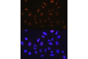 Immunofluorescence analysis of U-2 OS cells using Fibrillarin/U3 RNP Rabbit mAb (ABIN7267175) at dilution of 1:100 (40x lens). (Fibrillarin Antikörper)