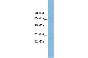 WB Suggested Anti-GRAP Antibody Titration: 0. (GRAP Antikörper  (Middle Region))