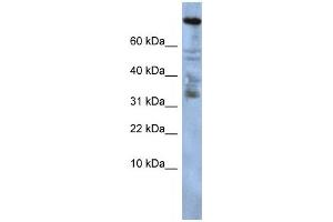 Western Blotting (WB) image for anti-Zinc Finger Protein 251 (ZNF251) antibody (ABIN2458235) (ZNF251 Antikörper)