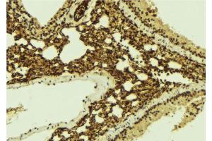 ABIN6267125 at 1/100 staining Mouse lung tissue by IHC-P.
