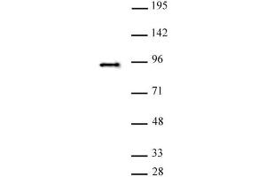 SATB2 antibody (pAb) tested by Western blot. (SATB2 Antikörper  (C-Term))