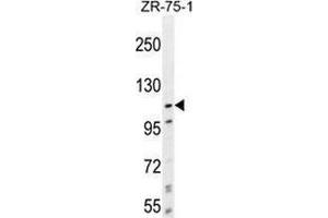 Western blot analysis in ZR-75-1 cell line lysates (35ug/lane) using PCDHA8 Antibody . (PCDHa8 Antikörper  (C-Term))