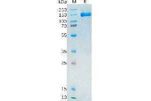 Human PSMA Protein, hFc Tag on SDS-PAGE under reducing condition.