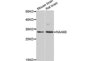 Western blot analysis of extracts of various cell lines, using NAA60 antibody (ABIN5975517) at 1/1000 dilution. (NAT15 Antikörper)