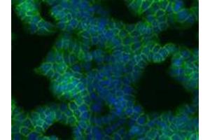 Immunofluorescence (IF) image for anti-Catenin (Cadherin-Associated Protein), beta 1, 88kDa (CTNNB1) antibody (ABIN614788) (CTNNB1 Antikörper)