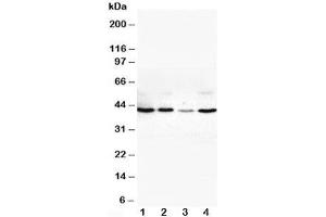 Western blot testing of VEGFD antibody and Lane 1:  SW620;  2: COLO320;  3: 6T-CEM;  4: HT1080 cell lysate (VEGFD Antikörper  (Middle Region))