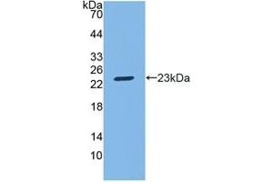 Detection of Recombinant SGPL1, Mouse using Polyclonal Antibody to Sphingosine 1 Phosphate Lyase 1 (SGPL1) (SGPL1 Antikörper  (AA 382-568))