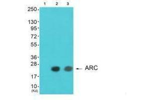 Western blot analysis of extracts from HeLa cells and A549 cells using ARC antibody. (ARC Antikörper)
