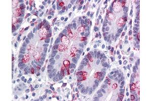 anti-Zinc Finger, BED-Type Containing 3 (ZBED3) (N-Term) antibody