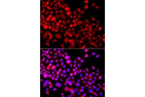 Immunofluorescence analysis of A549 cells using CALCOCO1 antibody (ABIN5975736). (CALCOCO1 Antikörper)