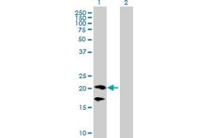 Western Blot analysis of CD160 expression in transfected 293T cell line by CD160 MaxPab polyclonal antibody.