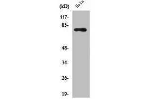 Western Blot analysis of HELA cells using Phospho-Btk (Y551) Polyclonal Antibody (BTK Antikörper  (pTyr551))