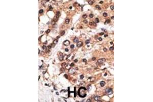 Immunohistochemistry (IHC) image for anti-Protein AF-9 (MLLT3) antibody (ABIN2971008) (AF9 Antikörper)