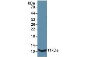 Detection of Recombinant IL13Ra2, Mouse using Polyclonal Antibody to Interleukin 13 Receptor Alpha 2 (IL13Ra2) (IL13RA2 Antikörper  (AA 228-338))