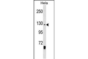 Western blot analysis in Hela cell line lysates (35ug/lane). (WHSC1 Antikörper  (C-Term))