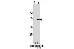 Western blot analysis of LPXN using rabbit polyclonal LPXN Antibody using 293 cell lysates (2 ug/lane) either nontransfected (Lane 1) or transiently transfected (Lane 2) with the LPXN gene. (Leupaxin Antikörper  (AA 229-257))