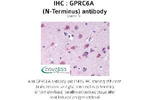 Image no. 1 for anti-G Protein-Coupled Receptor, Family C, Group 6, Member A (GPRC6A) (Extracellular Domain), (N-Term) antibody (ABIN1735225)