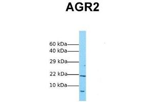 Host:  Rabbit  Target Name:  AGR2  Sample Tissue:  Human MCF7  Antibody Dilution:  1.
