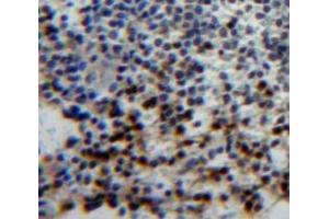 #VALUE! (T-Bet Antikörper  (AA 160-399))