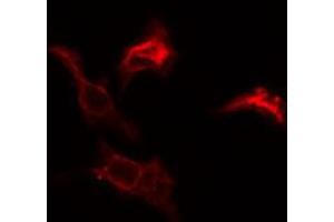 ABIN6274782 staining COLO205 cells by IF/ICC. (RPL39 Antikörper  (C-Term))